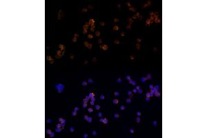 Immunofluorescence analysis of U-937 cells using RC / RABL Rabbit mAb (ABIN7269811) at dilution of 1:100 (40x lens). (Rab5c antibody)