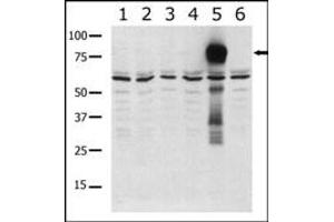 Western blot analysis of anti-K5 b (ABIN392438 and ABIN2842036) in lysates from transiently transfected COS7 cells. (PAK7 antibody  (AA 168-198))
