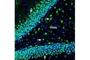 Expression of NHE-6 in rat hippocampus - Immunohistochemical staining of perfusion-fixed frozen rat brain sections with Anti-Na+/H+ Exchanger 6 (NHE-6) Antibody (ABIN7043760, ABIN7044871 and ABIN7044872), (1:200), followed by goat-anti-rabbit-AlexaFluor-488. (SLC9A6 antibody  (C-Term, Intracellular))