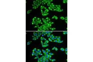 Immunofluorescence analysis of HeLa cells using DDX3X antibody. (DDX3X antibody)
