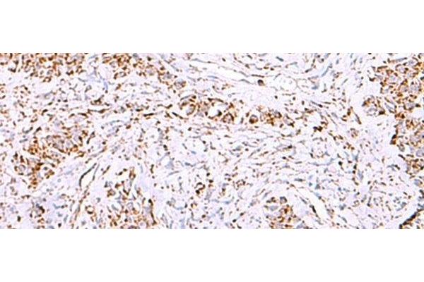 HSF2BP antibody