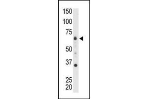 The anti-MTMR8 C-term Pab is used in Western blot to detect MTMR8 in mouse heart tissue lysate. (MTMR8 antibody  (C-Term))