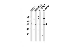 All lanes : Anti-FGFR1OP2 Antibody at 1:4000 dilution Lane 1: NIH/3T3 whole cell lysate Lane 2: R whole cell lysate Lane 3: NCI- whole cell lysate Lane 4: mouse thymus lysate Lysates/proteins at 20 μg per lane.