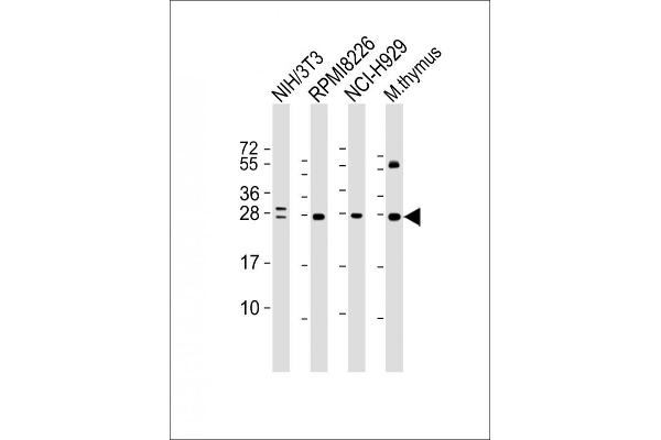 FGFR1OP2 antibody  (AA 1-172)