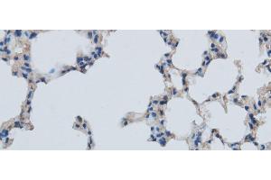 Immunohistochemistry of paraffin-embedded Mouse lung using MMP1 Polyclonal Antibody at dilution of 1:50 (MMP1 antibody)