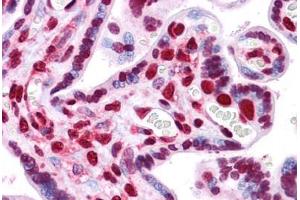 Human Placenta: Formalin-Fixed, Paraffin-Embedded (FFPE) (HMGB1 antibody  (AA 1-91))