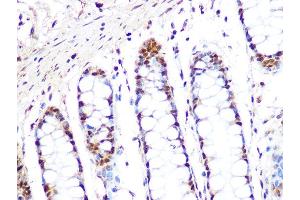 Immunohistochemistry of paraffin-embedded human colon using PRMT1 Rabbit mAb  at dilution of 1:100 (40x lens). (PRMT1 antibody)
