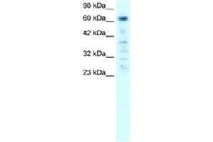 Western Blotting (WB) image for anti-Poly (ADP-Ribose) Polymerase Family, Member 3 (PARP3) antibody (ABIN2460803) (PARP3 antibody)
