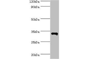Western blot All lanes: RNF212 antibody at 14 μg/mL + HepG2 whole cell lysate Secondary Goat polyclonal to rabbit IgG at 1/10000 dilution Predicted band size: 34, 15, 22, 32, 27, 31 kDa Observed band size: 34 kDa (RNF212 antibody  (AA 1-297))