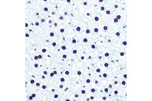 Immunohistochemistry (IHC) image for anti-Heterogeneous Nuclear Ribonucleoprotein U (Scaffold Attachment Factor A) (HNRNPU) antibody (ABIN1679689)