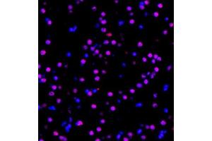 Immunofluorescent analysis of paraffin embedded mouse brain using MED8 (ABIN7074582) at dilution of 1: 600