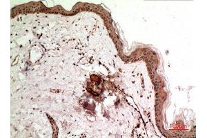 Immunohistochemistry (IHC) analysis of paraffin-embedded Human Skin, antibody was diluted at 1:100. (Synovial Sarcoma, X Breakpoint 2B (SSX2B) (C-Term) antibody)