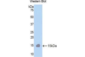 Western blot analysis of the recombinant protein. (CUBN antibody  (AA 3511-3623))
