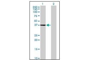 Western Blotting (WB) image for anti-Cyclin-Dependent Kinase 6 (CDK6) antibody (ABIN781963) (CDK6 antibody)