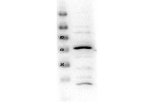 Western Blotting (WB) image for anti-Solute Carrier Family 2 (Facilitated Glucose Transporter), Member 2 (SLC2A2) (C-Term) antibody (ABIN5596790)
