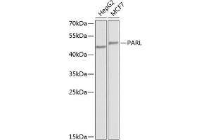 Western blot analysis of extracts of various cell lines, using PARL antibody (ABIN6132564, ABIN6145228, ABIN6145229 and ABIN6224252) at 1:1000 dilution.