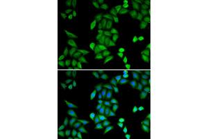 Immunofluorescence analysis of MCF-7 cells using RBPJ antibody.