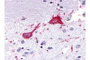 Immunohistochemical staining of Brain (Neurons and glia) using anti- KISS1R antibody ABIN122164 (KISS1R antibody  (Cytoplasmic Domain))