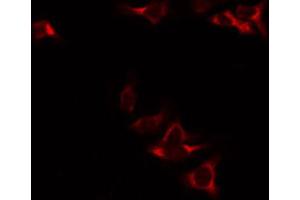 ABIN6272343 staining RAW264. (NAD-ME antibody  (Internal Region))