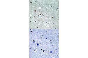 Immunohistochemical staining of human brain tissue by LATS1/LATS2 (phospho T1079/1041) polyclonal antibody  without blocking peptide (A) or preincubated with blocking peptide (B) under 1:50-1:100 dilution. (LATS1 antibody  (pThr1041, pThr1079))
