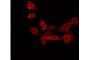 ABIN6274884 staining Hela by IF/ICC. (ABCD1 antibody  (Internal Region))