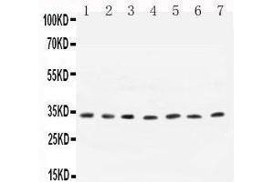 Anti- Cyclin D1 antibody,  All Western blotting All lanes: Anti-CCND1() at 0. (Cyclin D1 antibody  (C-Term))