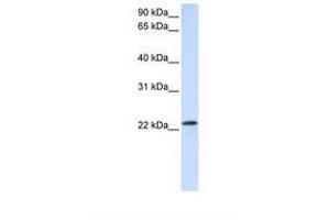 Image no. 1 for anti-RAB18, Member RAS Oncogene Family (RAB18) (C-Term) antibody (ABIN6737710) (RAB18 antibody  (C-Term))