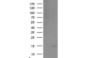 Western Blotting (WB) image for anti-Chromosome 17 Open Reading Frame 37 (C17orf37) antibody (ABIN1501777) (C17orf37 antibody)