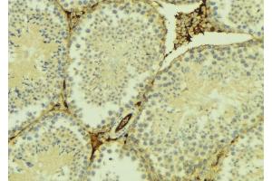 ABIN6275107 at 1/100 staining Mouse testis tissue by IHC-P. (ELOVL5 antibody  (C-Term))