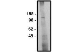 Image no. 1 for anti-Solute Carrier Family 9 (Sodium/hydrogen Exchanger), Member 6 (SLC9A6) antibody (ABIN265251) (SLC9A6 antibody)