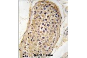 Formalin-fixed and paraffin-embedded human testis tissue reacted with RICTOR antibody (N-term) (ABIN391387 and ABIN2841395) , which was peroxidase-conjugated to the secondary antibody, followed by DAB staining. (RICTOR antibody  (N-Term))