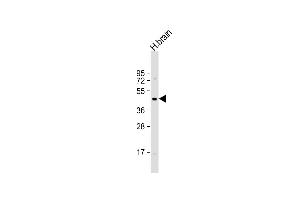 Anti-HRH3 Antibody (C-term) at 1:1000 dilution + human brain lysate Lysates/proteins at 20 μg per lane. (HRH3 antibody  (C-Term))