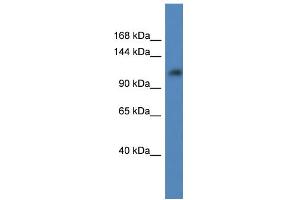 WB Suggested Anti-ANKRD27 AntibodyTitration: 1. (ANKRD27 antibody  (C-Term))