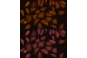 Immunofluorescence analysis of L929 cells using GCLC Rabbit pAb (ABIN6130444, ABIN6141016, ABIN6141017 and ABIN6214615) at dilution of 1:100 (40x lens). (GCLC antibody  (AA 1-252))