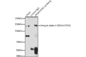 Immunoprecipitation analysis of 200 μg extracts of C6 cells using 3 μg Integrin alpha V (ITGAV/CD51) antibody (ABIN3022887, ABIN3022888, ABIN3022889 and ABIN6219281). (CD51 antibody  (C-Term))