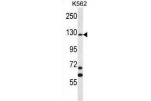 Western Blotting (WB) image for anti-MCF.2 Cell Line Derived Transforming Sequence (MCF2) antibody (ABIN2996823) (MCF2 antibody)