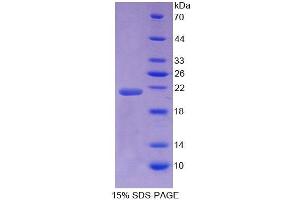 SDS-PAGE (SDS) image for N-Ethylmaleimide-Sensitive Factor (NSF) (AA 590-744) protein (His tag) (ABIN4989441) (NSF Protein (AA 590-744) (His tag))