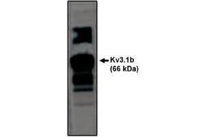 Image no. 1 for anti-Potassium Voltage-Gated Channel, Shaw-Related Subfamily, Member 1 (KCNC1) antibody (ABIN265028) (KCNC1 antibody)