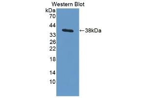 Detection of Recombinant ARPC2, Human using Polyclonal Antibody to Actin Related Protein 2/3 Complex Subunit 2 (ARPC2) (ARPC2 antibody  (AA 1-300))