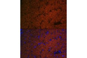 Immunofluorescence analysis of mouse brain using CNPase Rabbit mAb (ABIN7265322) at dilution of 1:100 (40x lens). (Cnpase antibody)