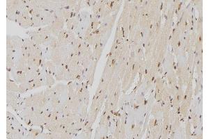 ABIN6262924 and ABIN6277599 at 1/100 staining Mouse heart tissue by IHC-P.