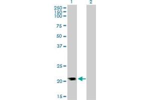 Western Blot analysis of RHOA expression in transfected 293T cell line by RHOA monoclonal antibody (M05), clone 1C1.