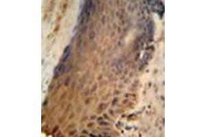 Immunohistochemistry analysis in formalin fixed and paraffin embedded human skin reacted with GFPT2 / GFAT2 Antibody (Center) followed which was peroxidase conjugated to the secondary antibody and followed by DAB staining. (GFPT2 antibody  (Middle Region))