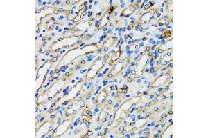 Immunohistochemistry of paraffin-embedded mouse kidney using COPB2 antibody. (COPB2 antibody)
