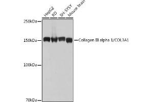 Western blot analysis of extracts of various cell lines, using Collagen III alpha 1/COL3 antibody (ABIN7266459) at 1:1000 dilution.