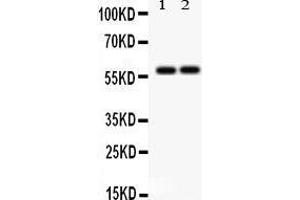 Anti-SCARB1 Picoband antibody, Western blotting All lanes: Anti SCARB1  at 0.