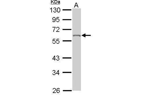 HNRNPK antibody