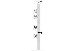 SULT1A2 Antibody (C-term) western blot analysis in K562 cell line lysates (35µg/lane). (SULT1A2 antibody  (C-Term))