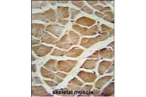 Immunohistochemistry (Paraffin-embedded Sections) (IHC (p)) image for anti-Dishevelled Associated Activator of Morphogenesis 1 (DAAM1) (AA 341-370), (N-Term) antibody (ABIN651631)