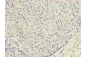 Immunohistochemistry of paraffin-embedded human pancreatic tissue using ABIN7173719 at dilution of 1:100 (TTLL7 antibody  (AA 1-260))
